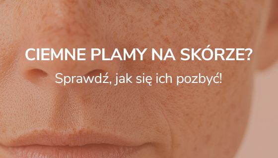 Ciemne plamy na skórze? Sprawdź, jak się ich pozbyć!  