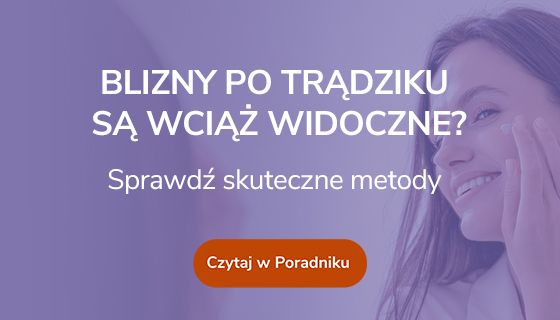 Blizny po trądziku są wciąż widoczne? Sprawdź skuteczne metody.