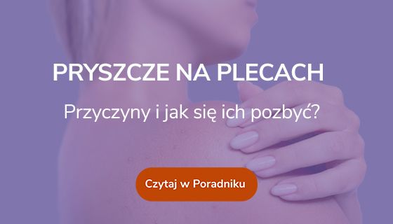 Pryszcze na plecach – przyczyny, jak się ich pozbyć? 